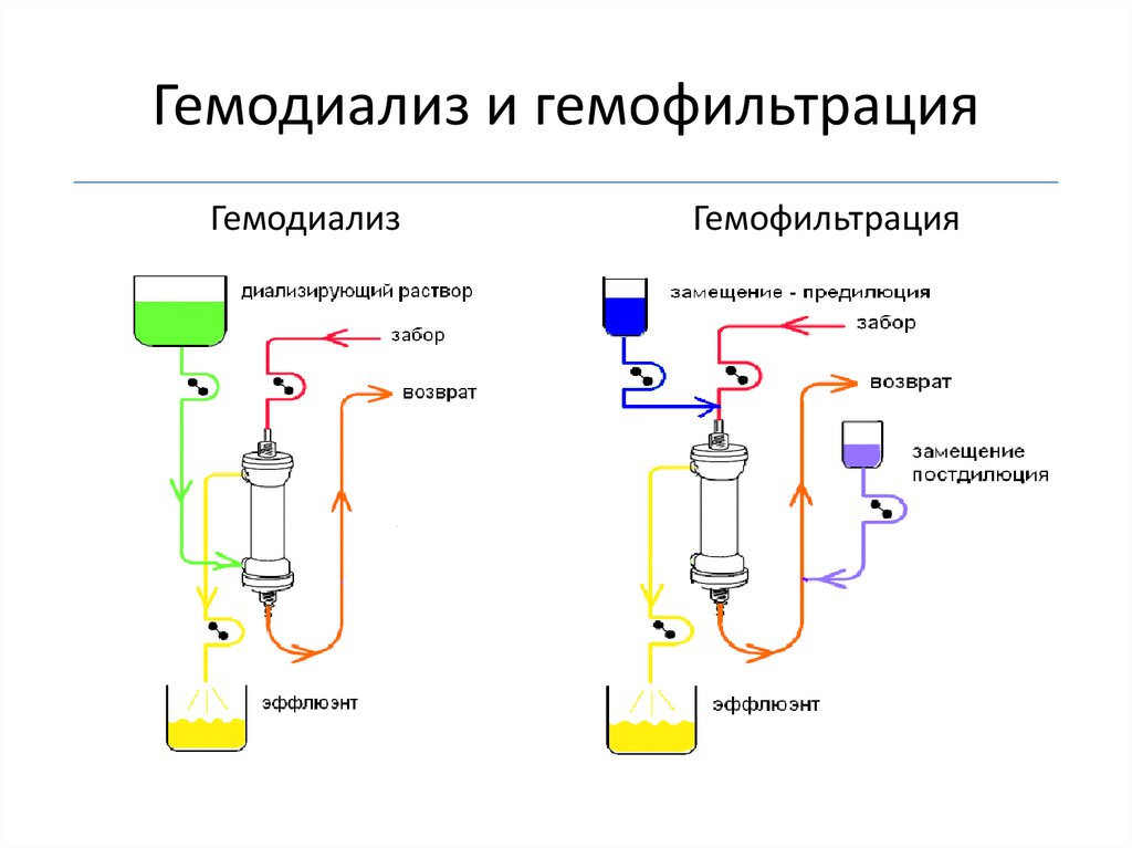 Принцип работы аппарата искусственная почка рисунок