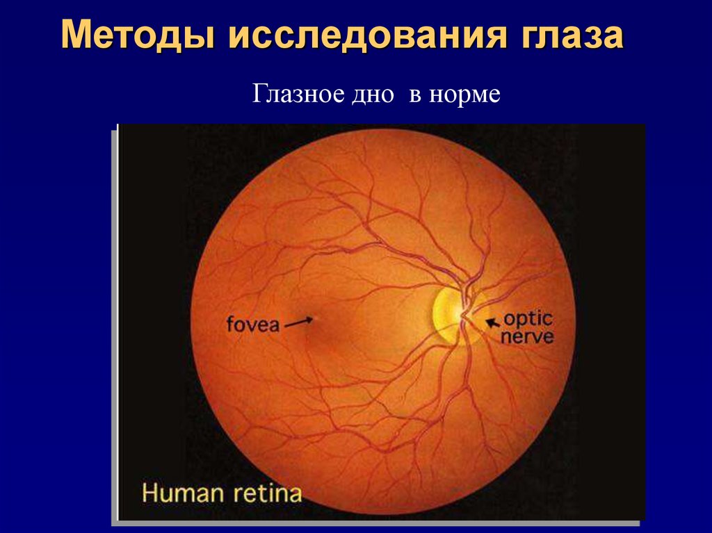 Методы исследования глаза