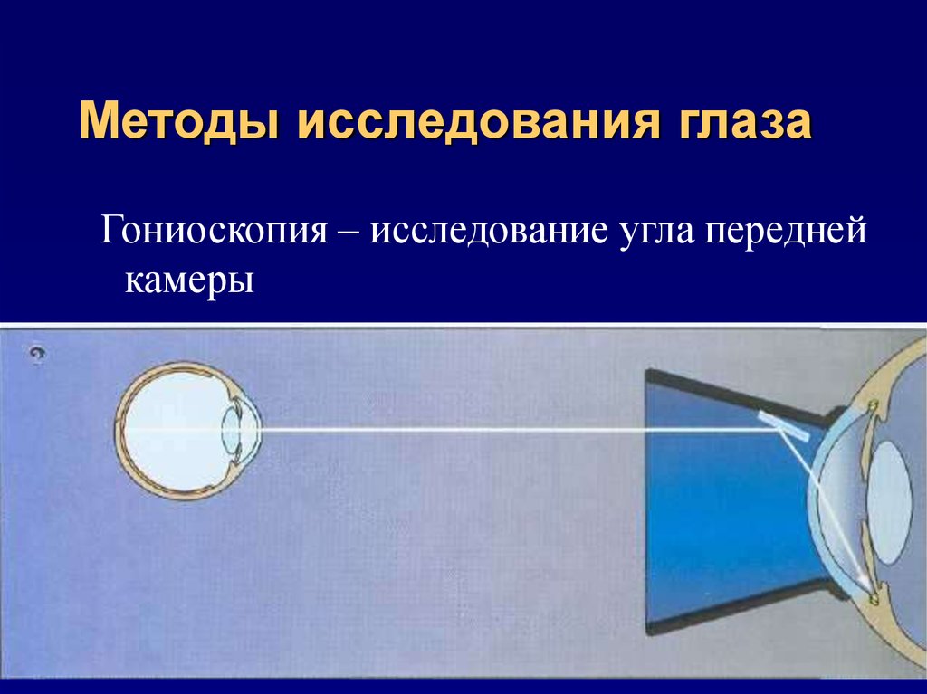 Современные методы исследования в офтальмологии презентация