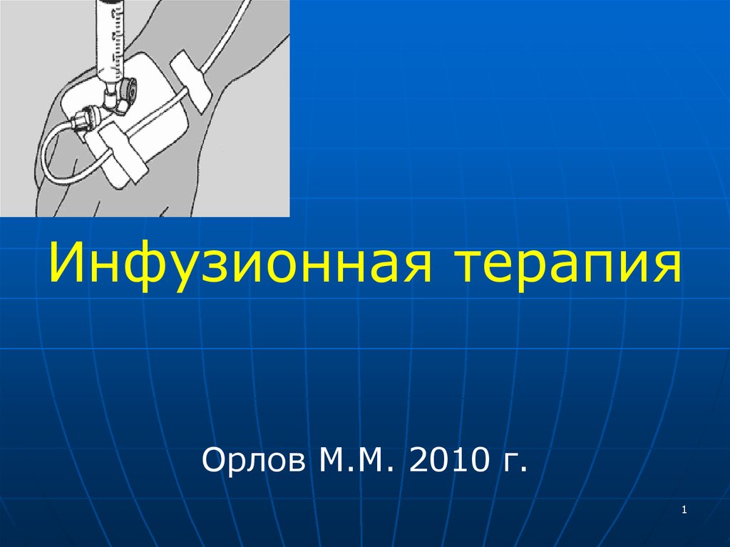 Инфузионная терапия картинки