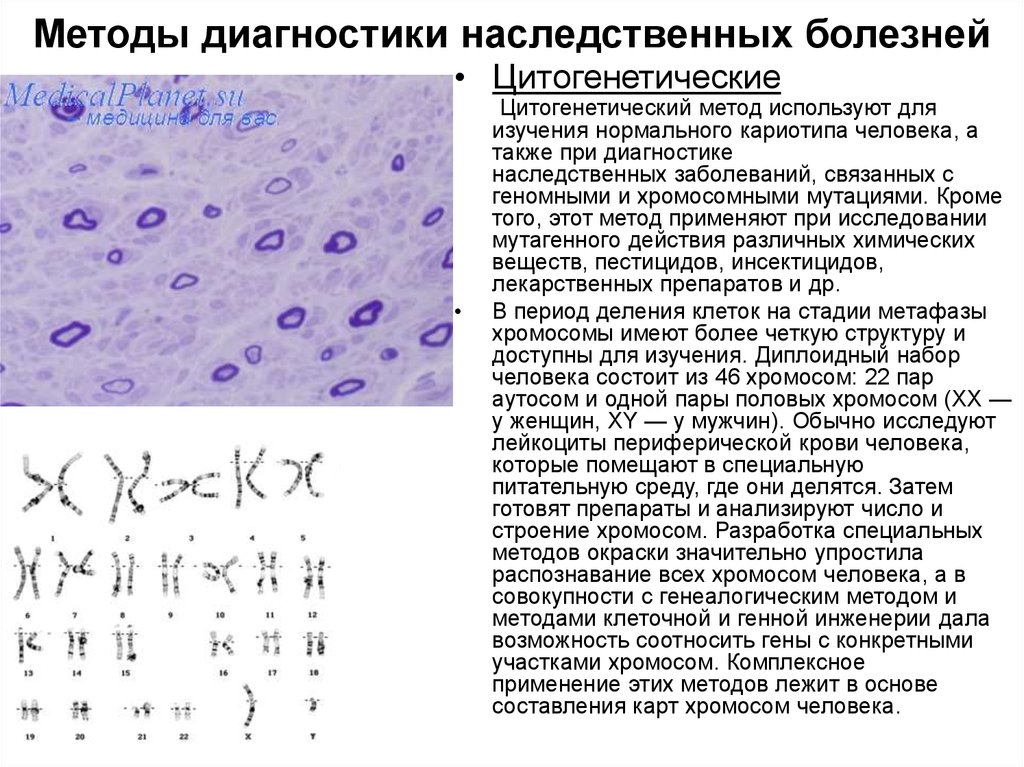 Выявление наследственных. Цитогенетические методы диагностики наследственных болезней. Цитогенетический метод диагностики наследственных болезней. Цитогенетический метод исследования наследственных заболеваний. Синдром Патау цитогенетический метод исследования.