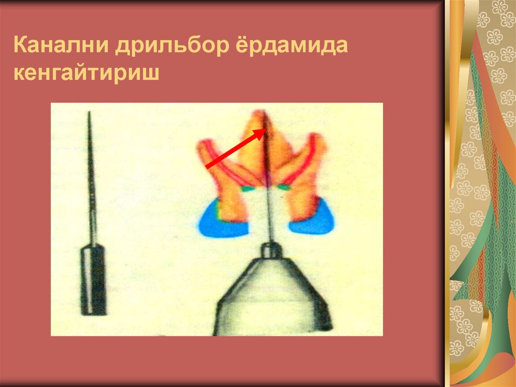 Канални дрильбор ёрдамида кенгайтириш