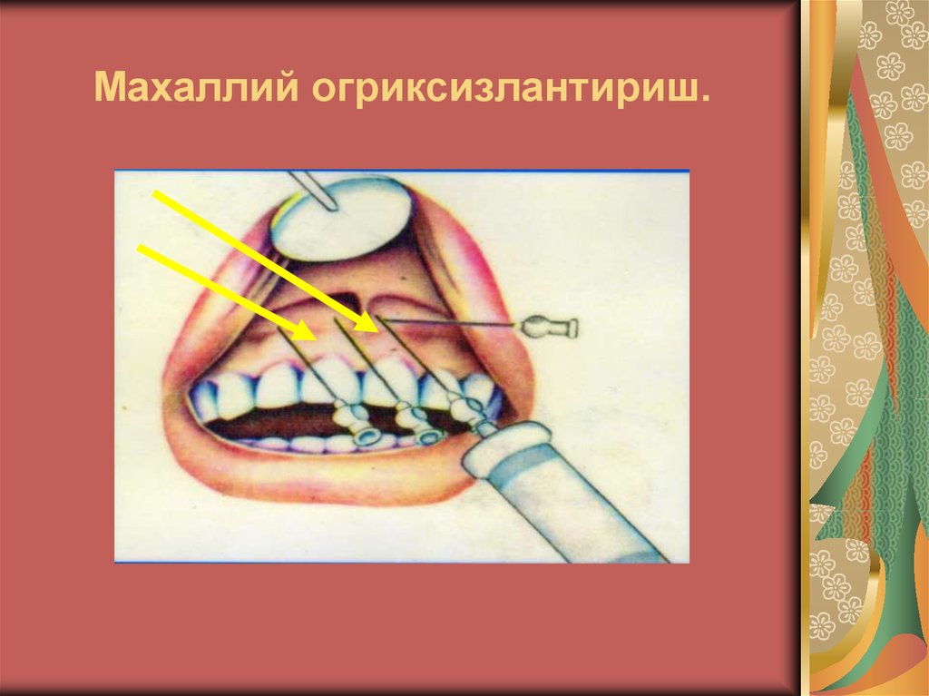 Махаллий огриксизлантириш.