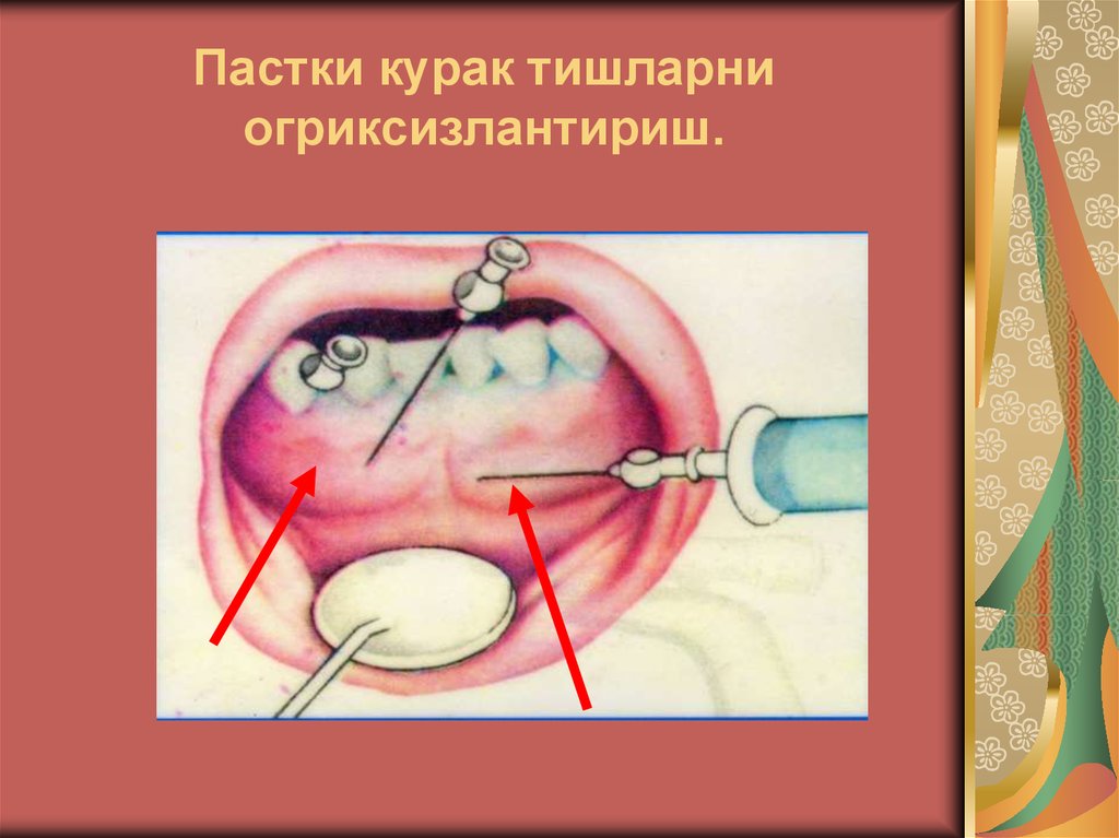 Пастки курак тишларни огриксизлантириш.