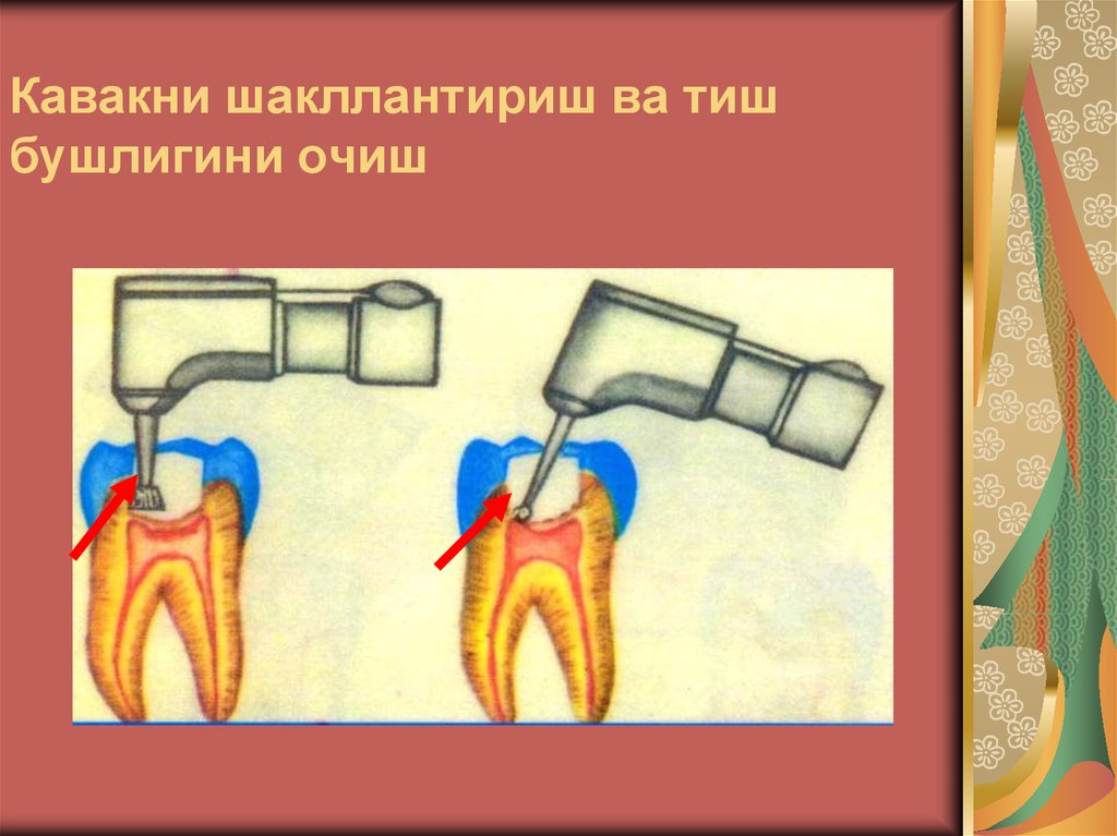 Кавакни шакллантириш ва тиш бушлигини очиш