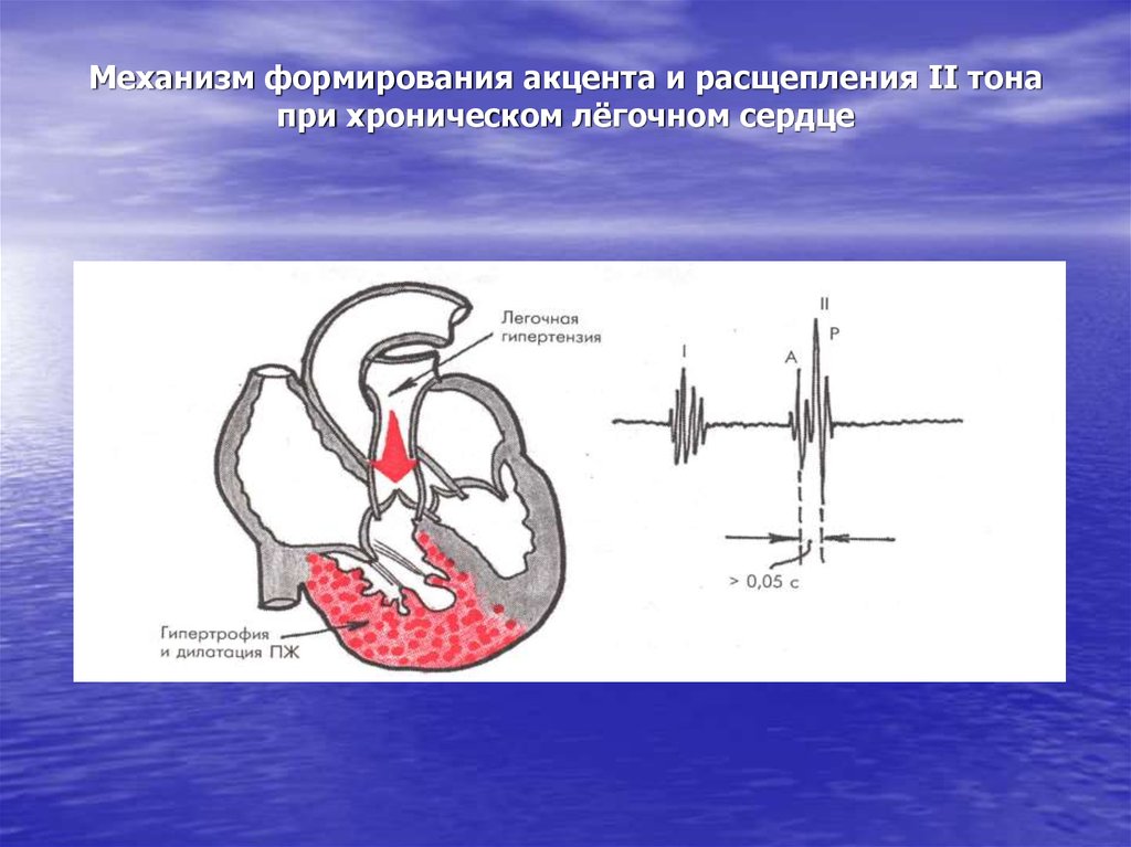 Легочное сердце тесты