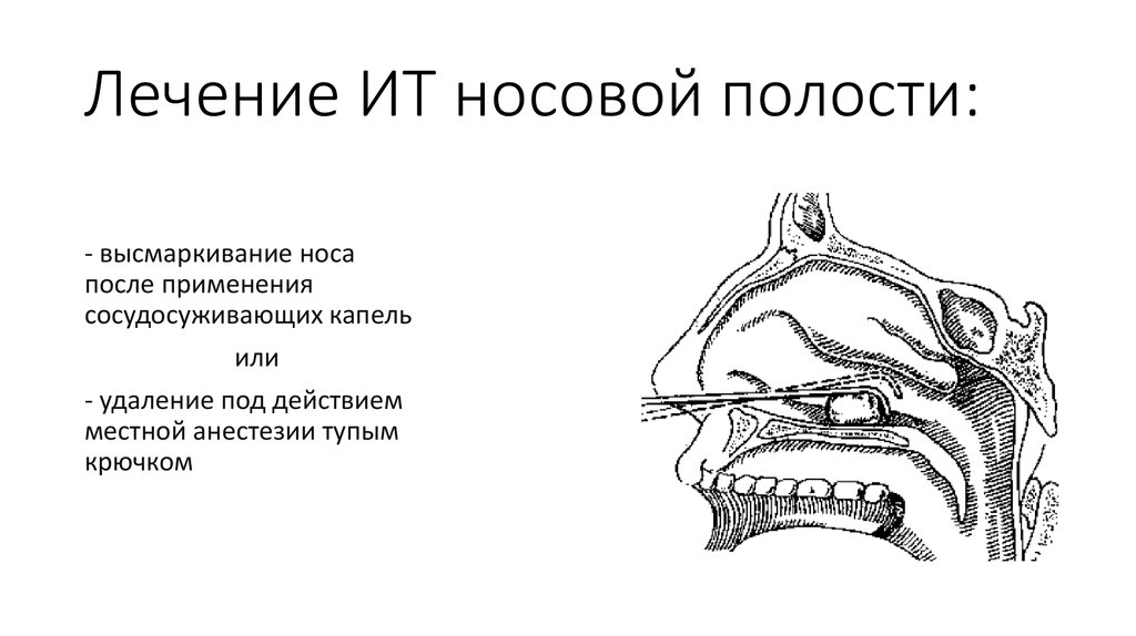 Инородные тела глотки презентация