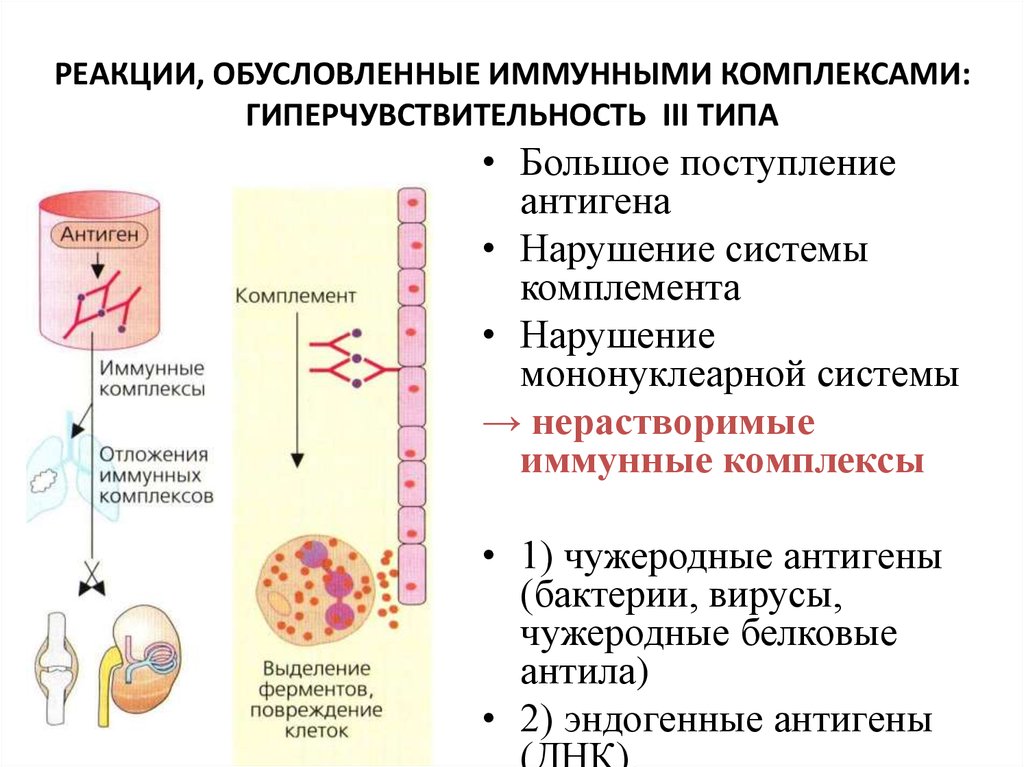 Реакции иммунного повреждения. Реакция гиперчувствительности 3 типа. Реакция гиперчувствительности 3 типа механизм. Схема аллергической реакции 3 типа. Иммунокомплексная реакция гиперчувствительности.