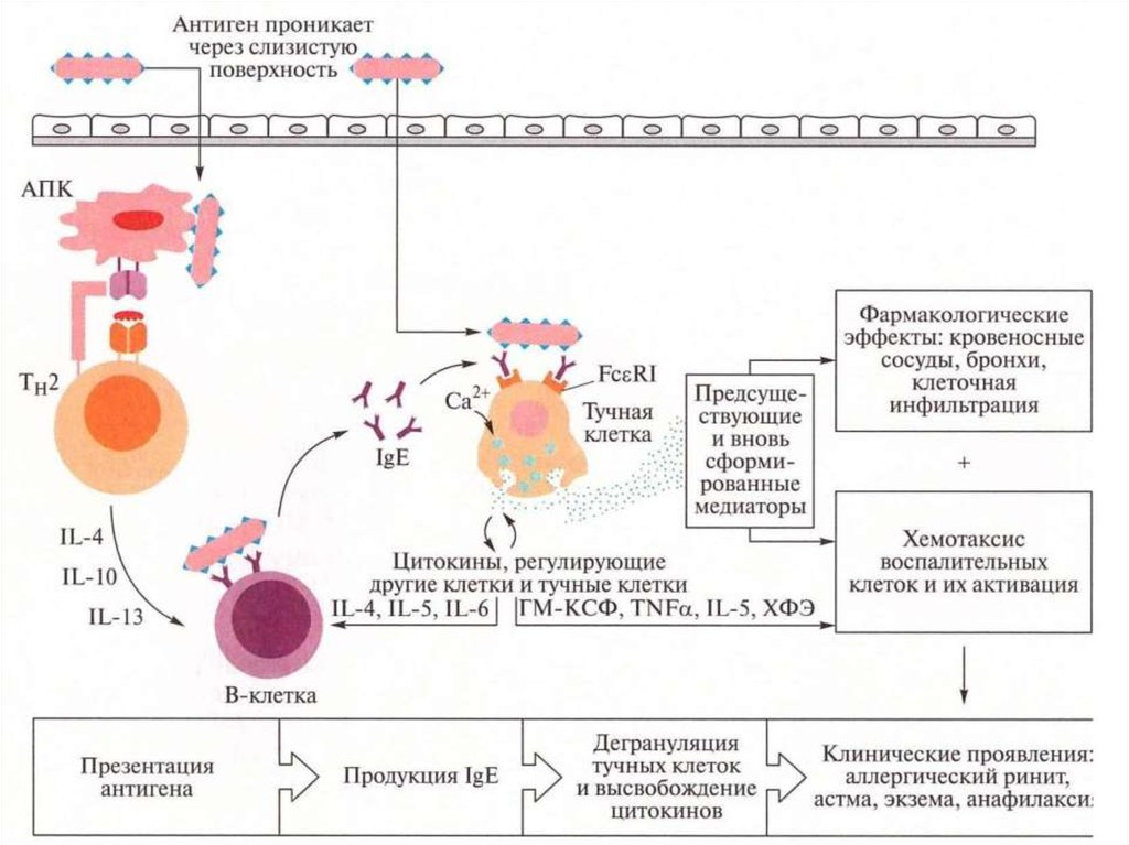 Аллергическая реакция немедленного типа это. Гиперчувствительность 1 типа схема. Аллергические реакции немедленного типа. Гиперчувствительность немедленного типа. Типы реакций гиперчувствительности.