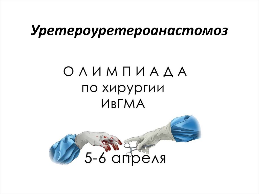 Уретероуретероанастомоз - презентация онлайн