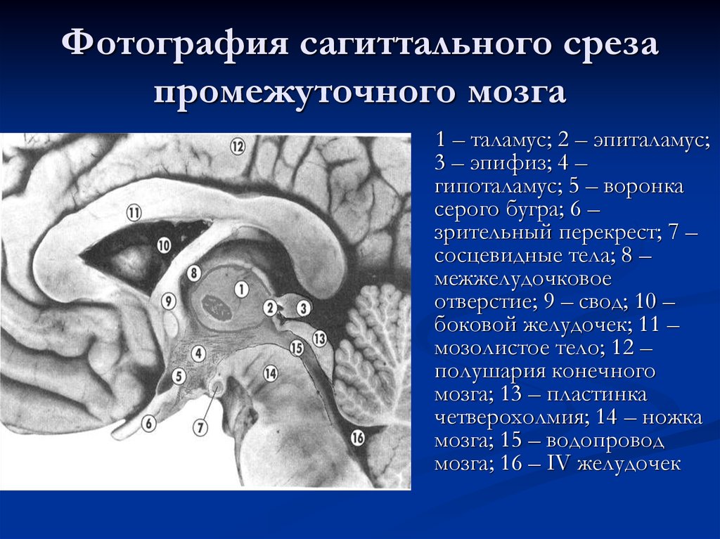 Серый мозг латынь. Промежуточный мозг Сагиттальный срез. Сосцевидные тела гипоталамуса. Сосцевидное тело промежуточный мозг. Промежуточный мозг в разрезе.