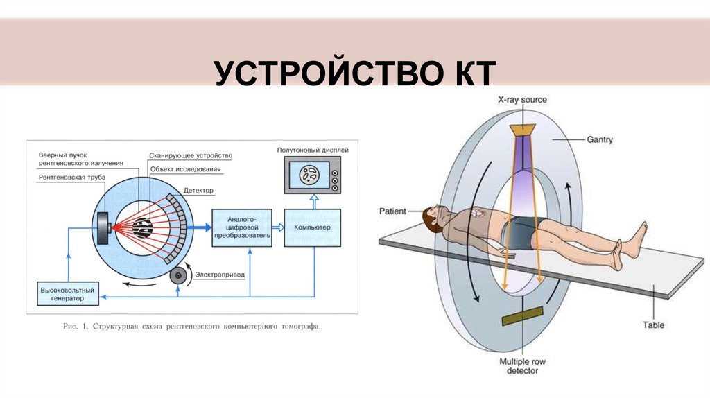 Принципы получения изображения. Схема рентгеновского компьютерного томографа. Схема строения компьютерного томографа. Принцип работы рентгеновского томографа. Структурная схема рентгеновского компьютерного томографа.