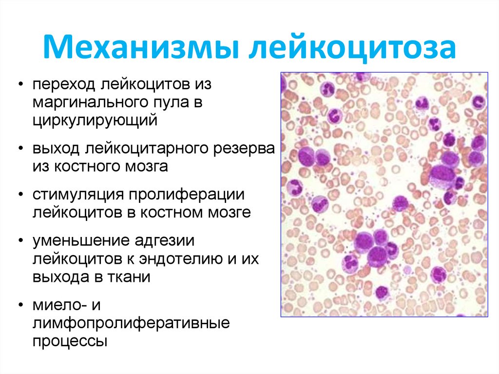 Реактивные изменения лейкоцитов