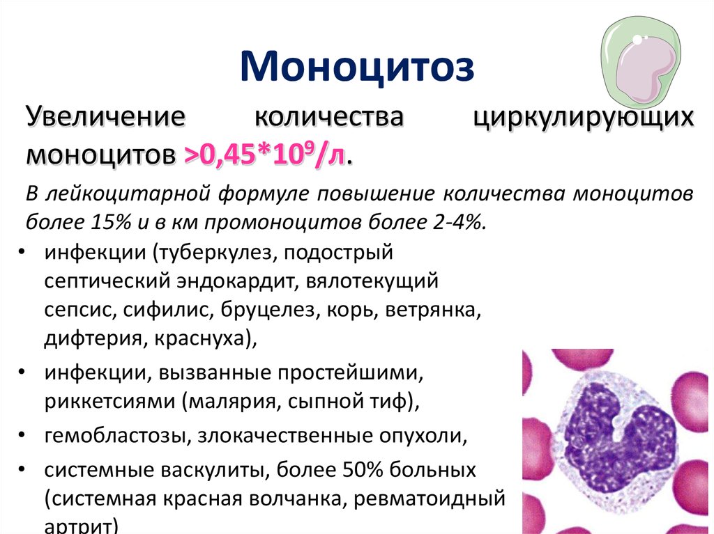 Моноцитов в крови 1. Моноциты повышены. Повышены моноциты в крови. Увеличение количества моноцитов. Причины повышения моноцитов.