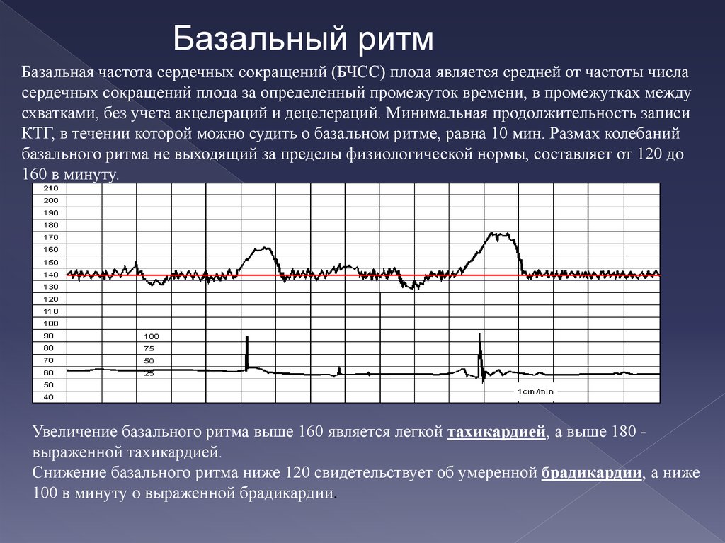 Ритмы чсс. Базальная ЧСС. Базальная частота сердечных сокращений плода. Базальный ритм ЧСС плода. Частота сердечных сокращений у плода.