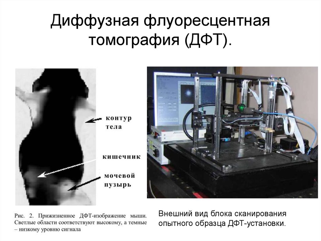 Диффузная флуоресцентная томография (ДФТ).