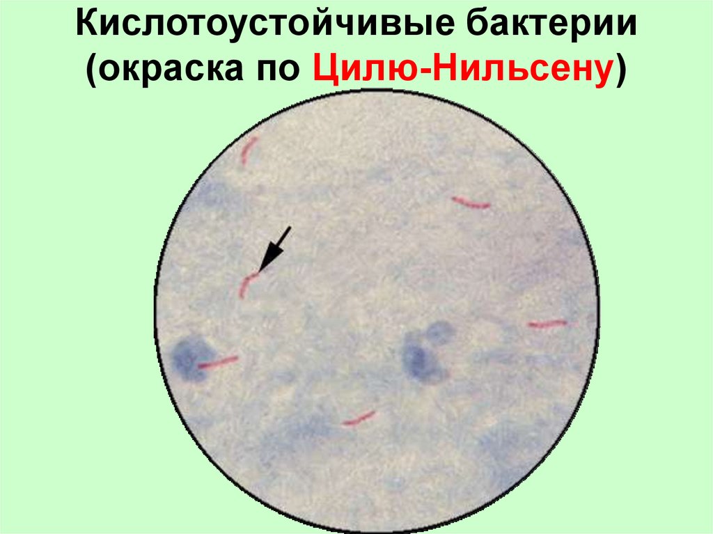 Окраска по трухио картинки