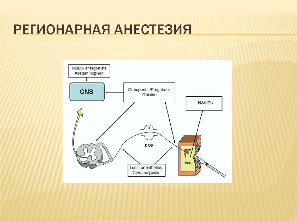 Регионарная анестезия у детей презентация