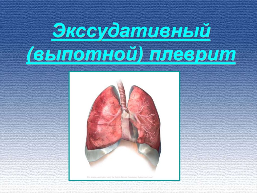 Плеврит легких. Экссудативный плеврит. Диафрагмальный плеврит.