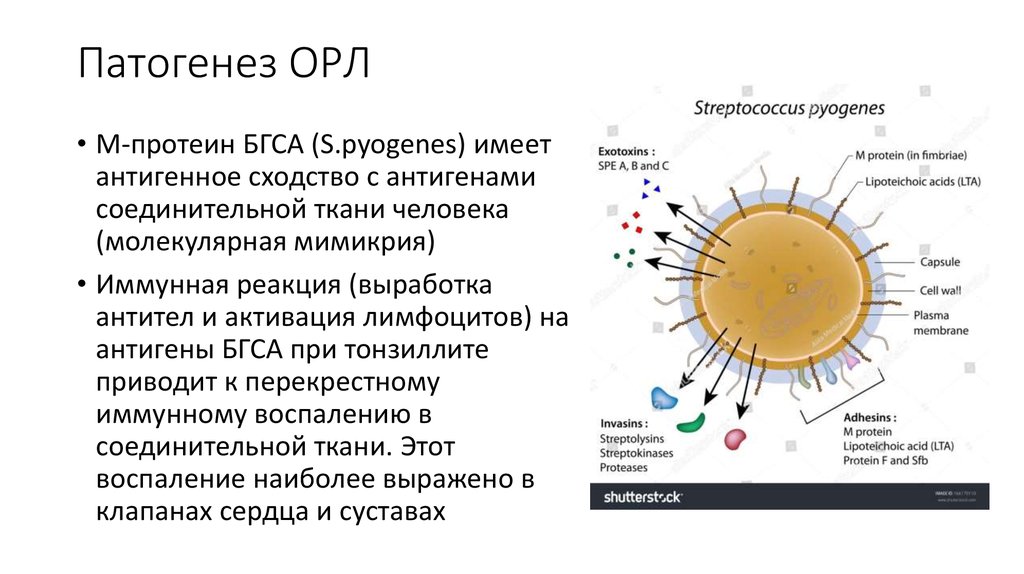 Клиническая картина орл