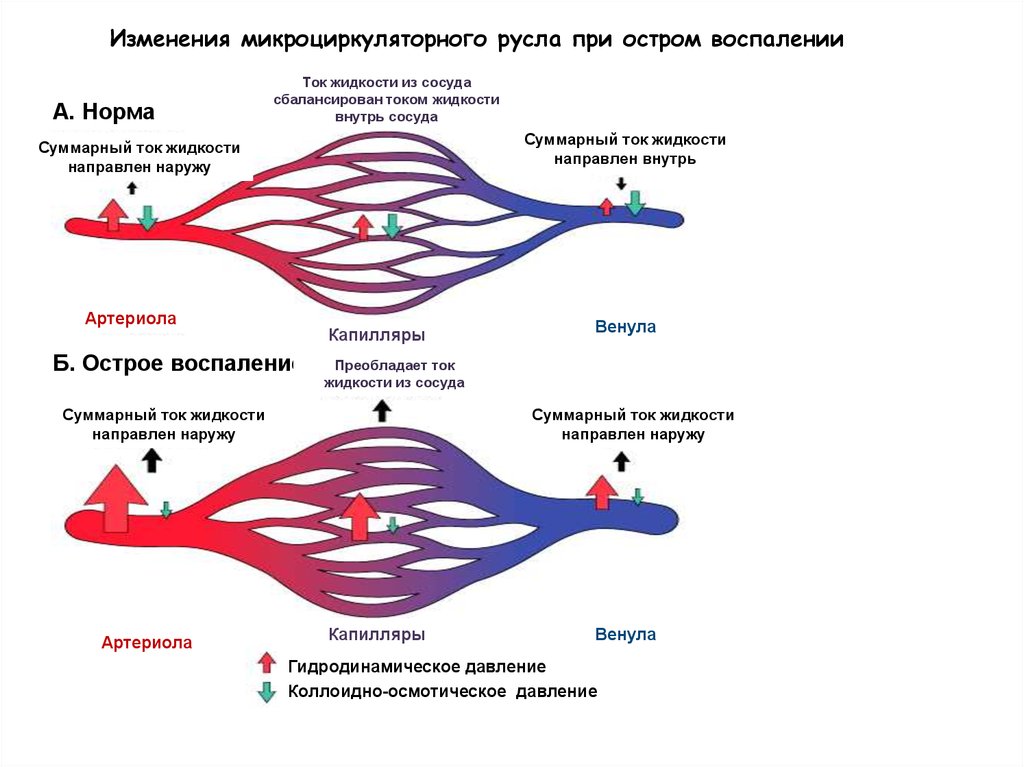 Воспаление жидкости. Схема микроциркуляторного русла патофизиология. Основные звенья микроциркуляторного русла. Схема нарушения микроциркуляции. Давление в микроциркуляторном русле.