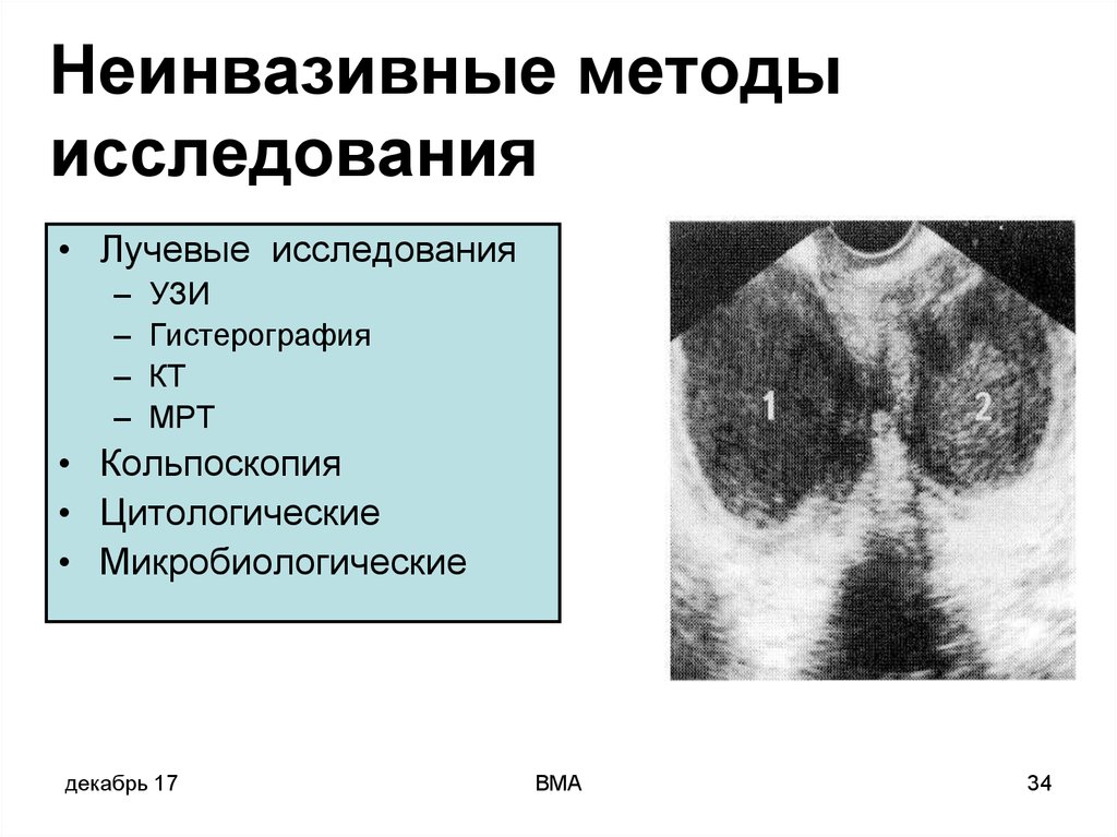 Лучевая диагностика в гинекологии презентация