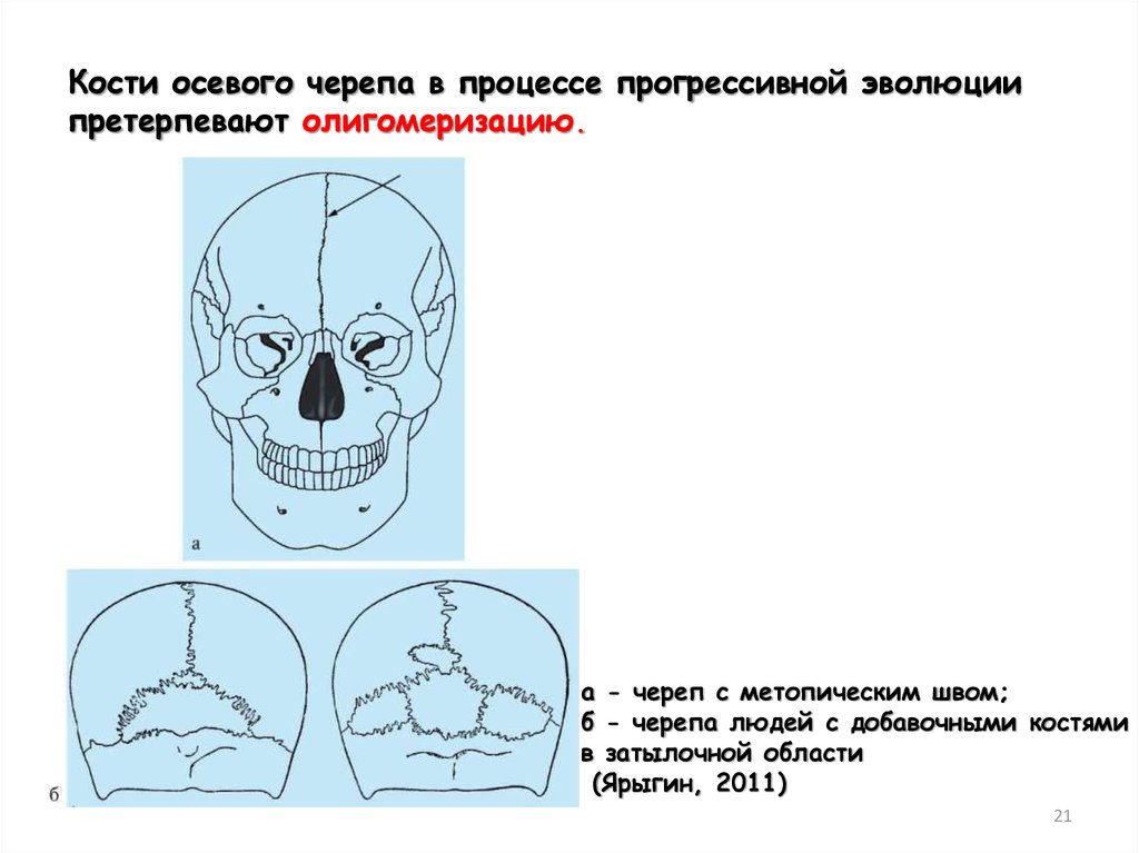 Врожденные аномалии костей черепа нмо ответы