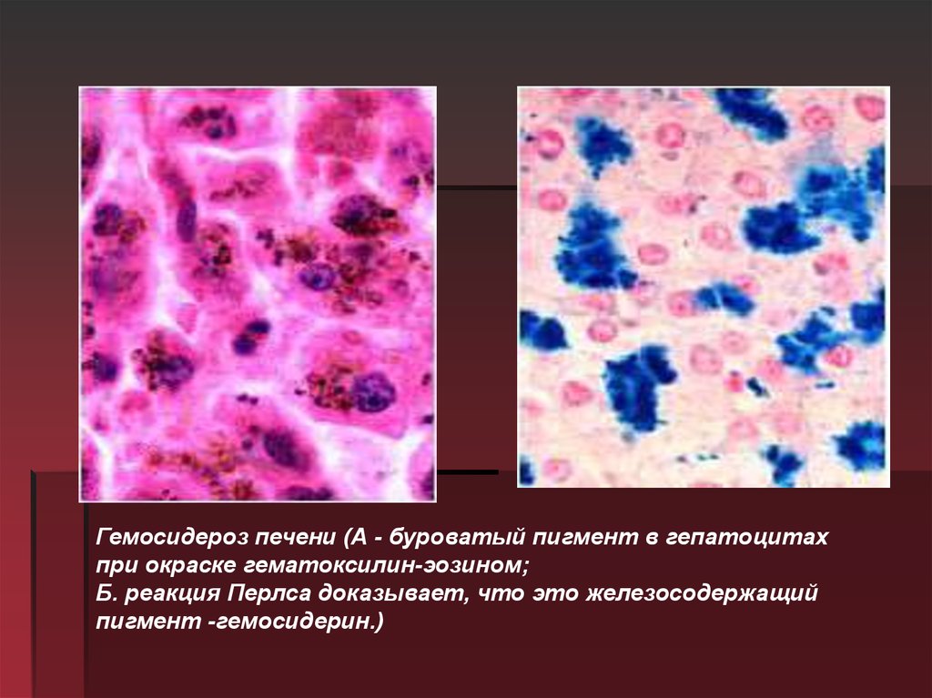 Реакция перлса