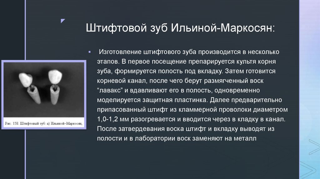 Показания к применению штифтовых. Штифтовой зуб по Ильиной-Маркосян. Этапы изготовления штифтового зуба по Ильиной-Маркосян. Штифтовые зубы по Ричмонду Ильиной-Маркосян Ахмедову. Вкладка Ильиной Маркосян.