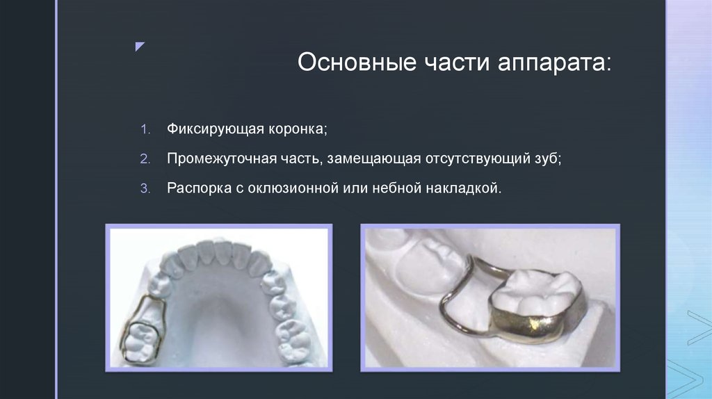 Профилактика аппарата. Несъемные профилактические аппараты. Кольцо с распоркой для зубов. Кольцо на зуб с распоркой. Кольцо с распоркой ортодонтия.