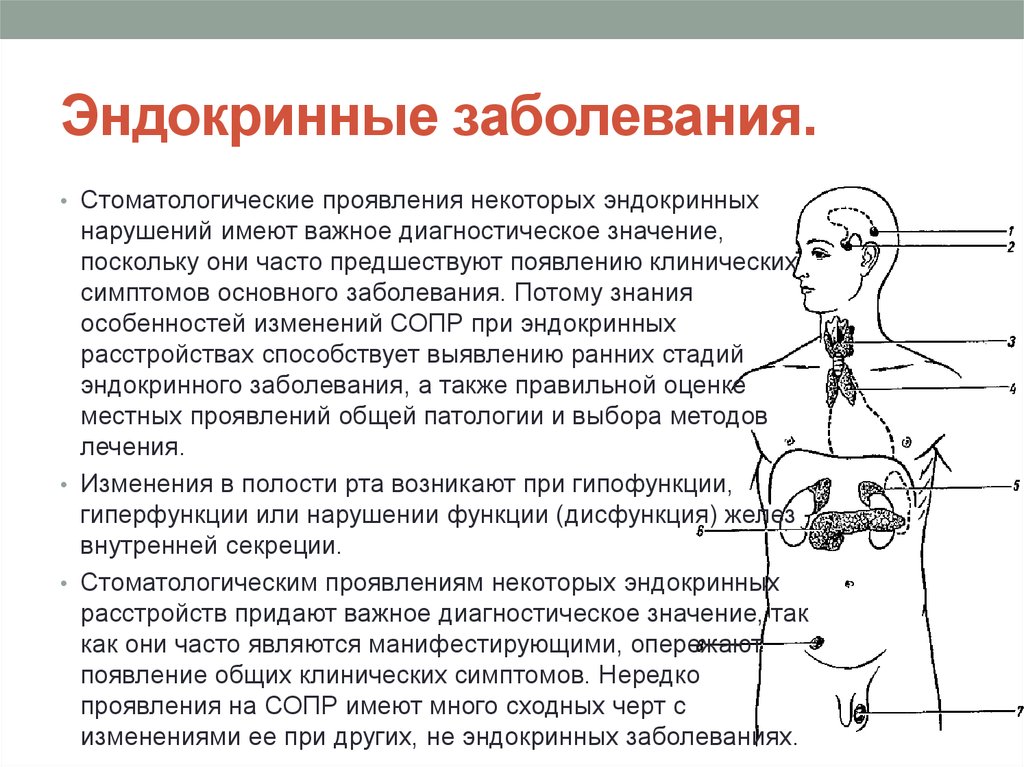 Заболевание эндокринной системы презентация