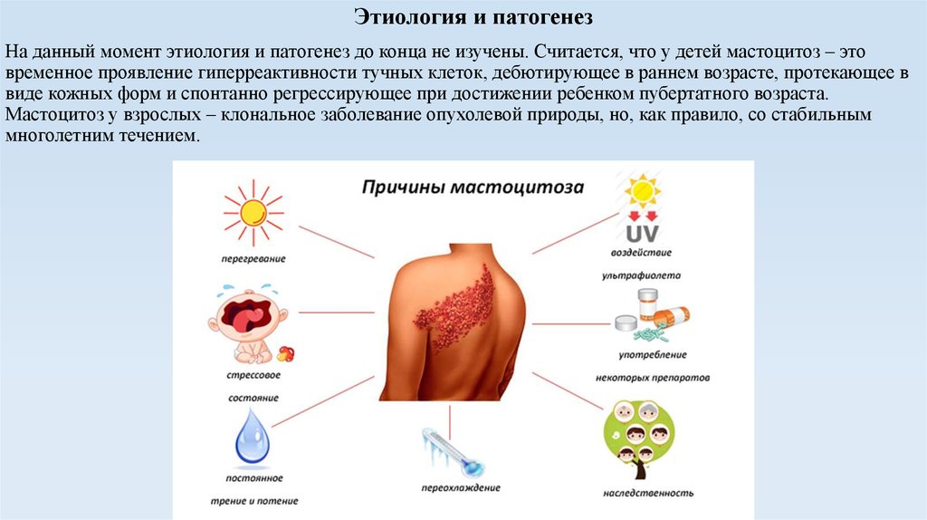 Этиология патогенез тест. Кожные проявления мастоцитоза. Мастоцитоз-солитарная мастоцитома.