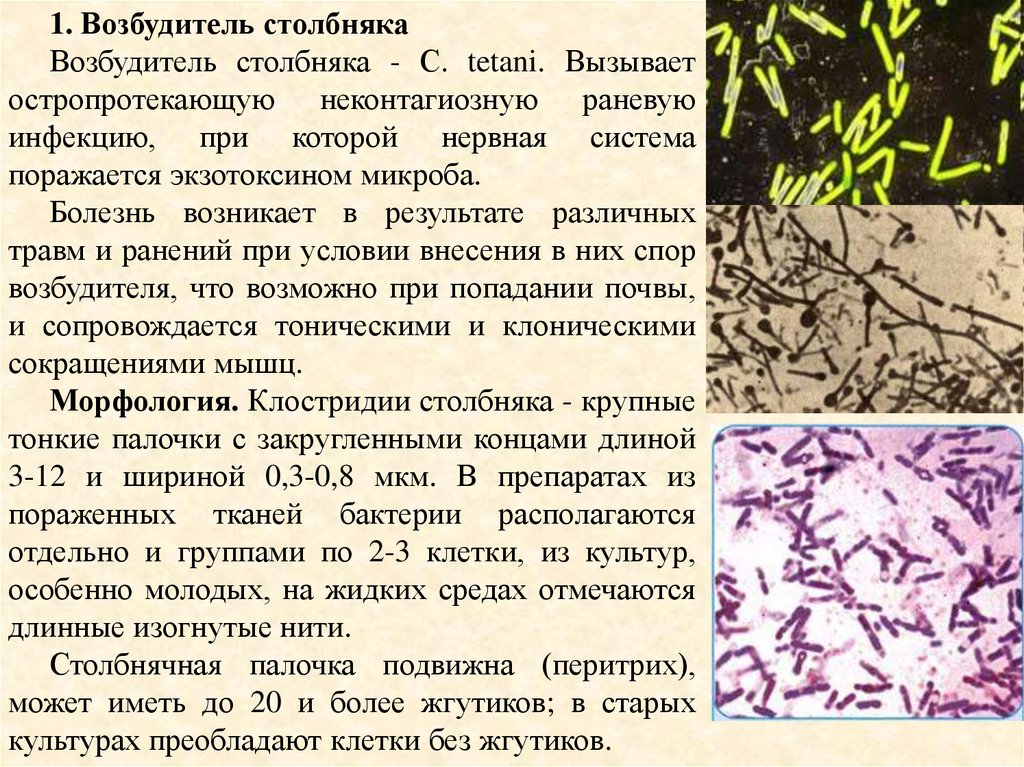 Анаэробные условно патогенные. Столбнячная палочка морфология. Клостридии возбудители столбняка. Столбнячная палочка микробиология. Столбнячная палочка Clostridium tetani.