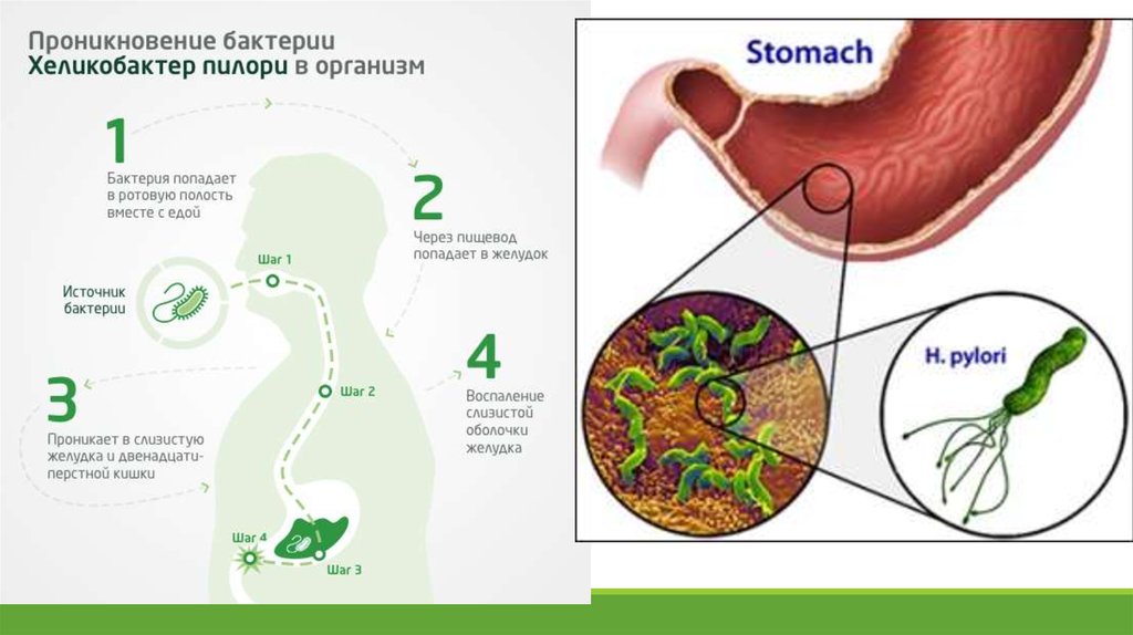 Que alimentos producen la bacteria helicobacter pylori