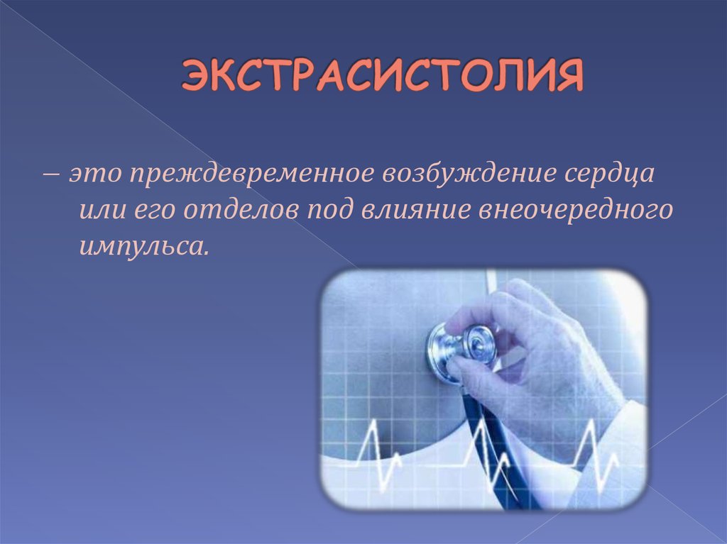 ЭКСТРАСИСТОЛИЯ