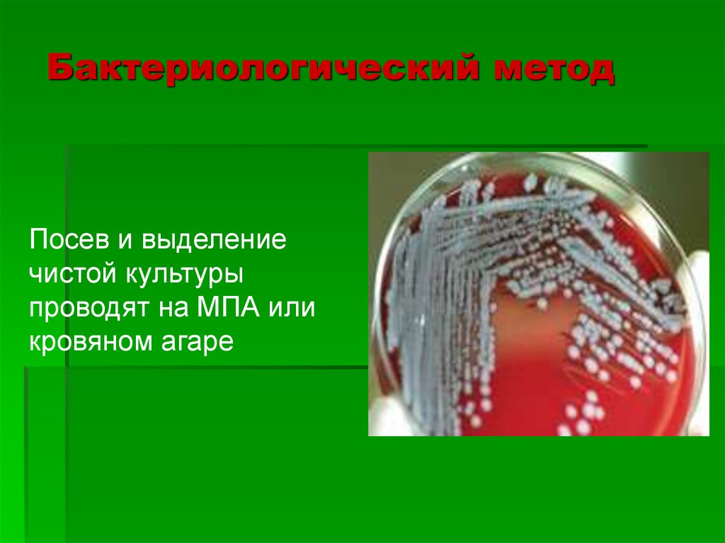 Посев мпа. Бактериологический метод. Посев чистой культуры. Выделение чистой культуры. Агар бактериологический.