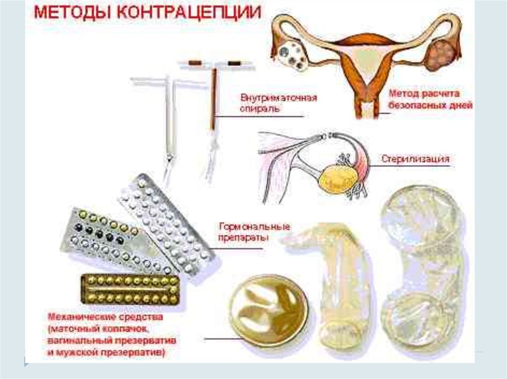 Можно ли заниматься сексом презервативом. Современные способы контрацепции. Современные методы контрацептивов. Виды контрацептивов для женщин. Способы контрацептивов для мужчин.