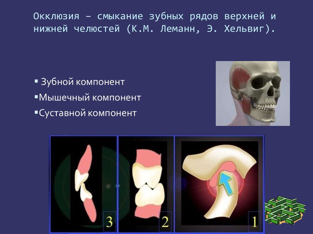 Окклюзия характеризуется. Зубной компонент центральной окклюзии. Передняя окклюзия зубной компонент. Центральная окклюзия суставной компонент.