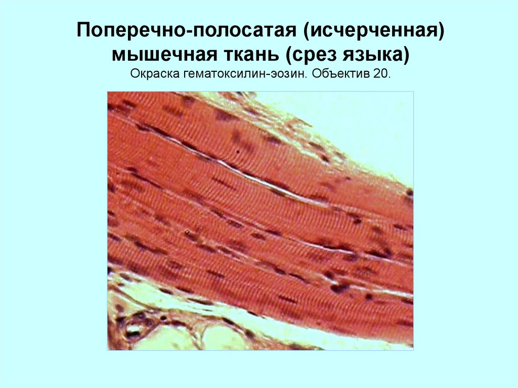 Поперечно полосатая мышечная. Поперечно исчерченная мышечная ткань. Поперечно-полосатая исчерченная ткань. Строение миофибрилл поперечно полосатой мышечной ткани. Поперечнополосатая мышечная ткань человека строение.