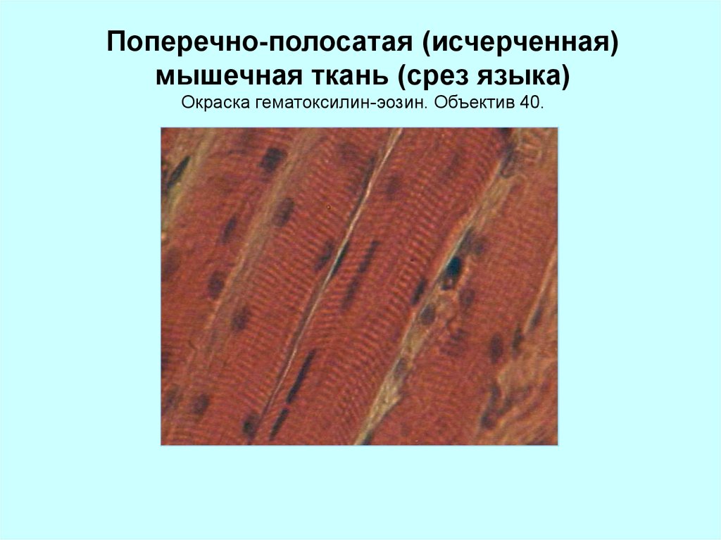 Поперечно полосатая мышечная ткань строение
