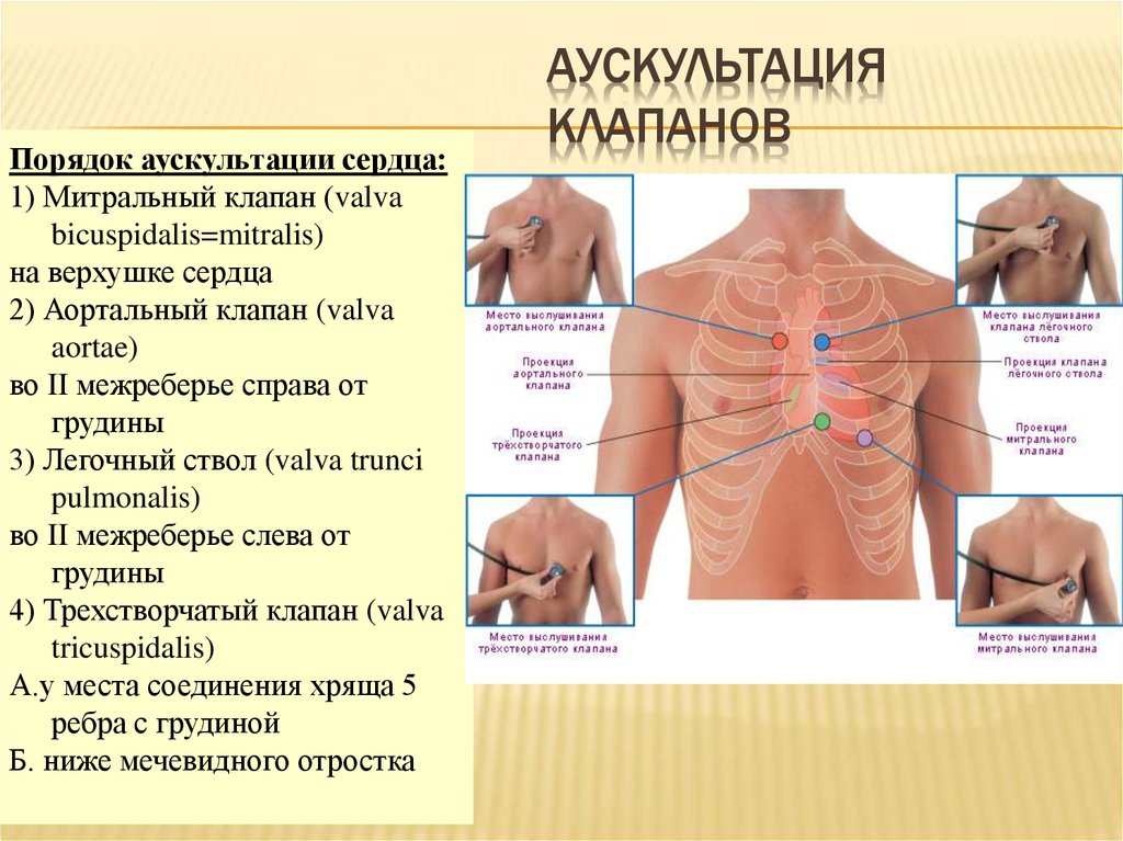 Прослушивание сердца схема