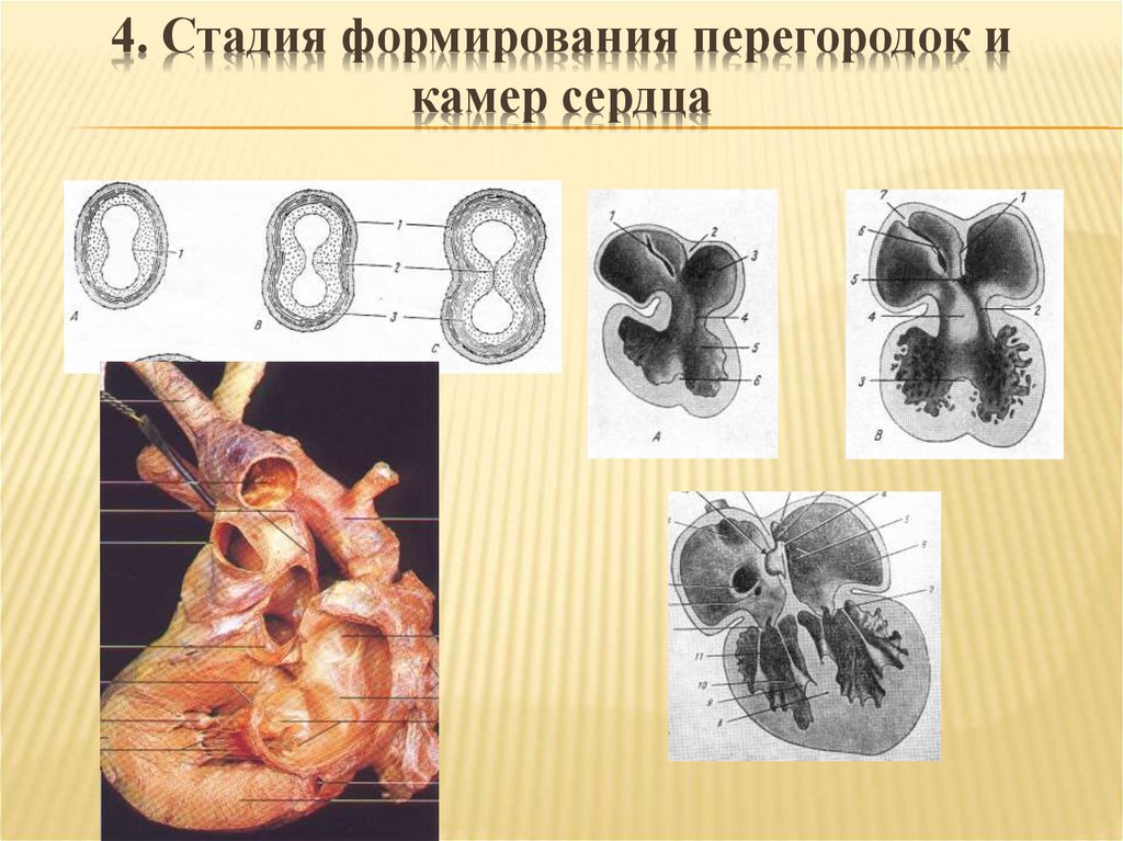 Если у животного сердце имеет строение отраженное на рисунке то для этого животного характерны