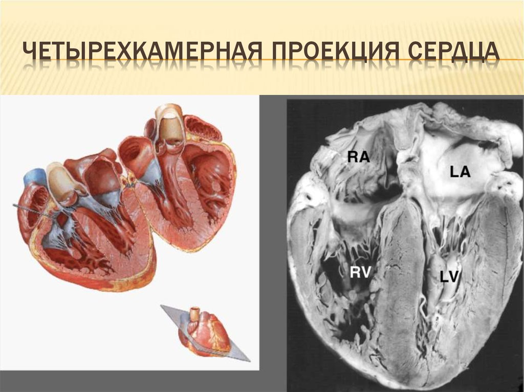 Проекция клапанов сердца