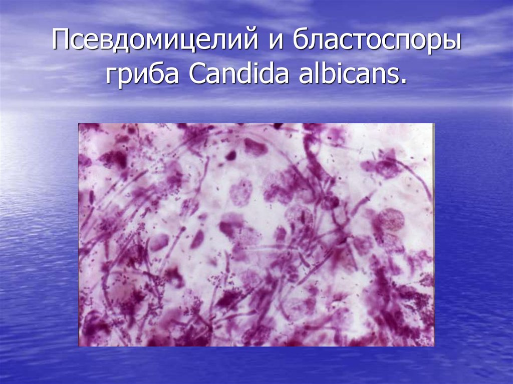Бластоспоры в мазке что это. Псевдомицелий гриба рода Candida. Бластоспоры и псевдомицелий. Candida albicans мицелий. Грибы кандида микроскопия.
