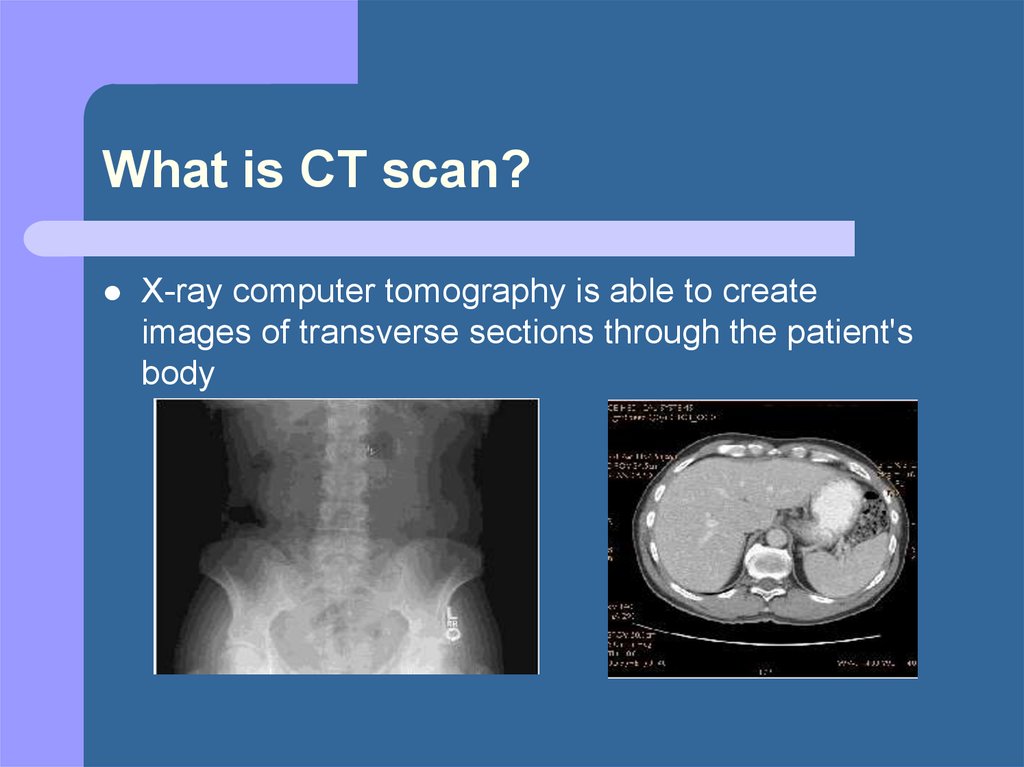 presentation on ct scan