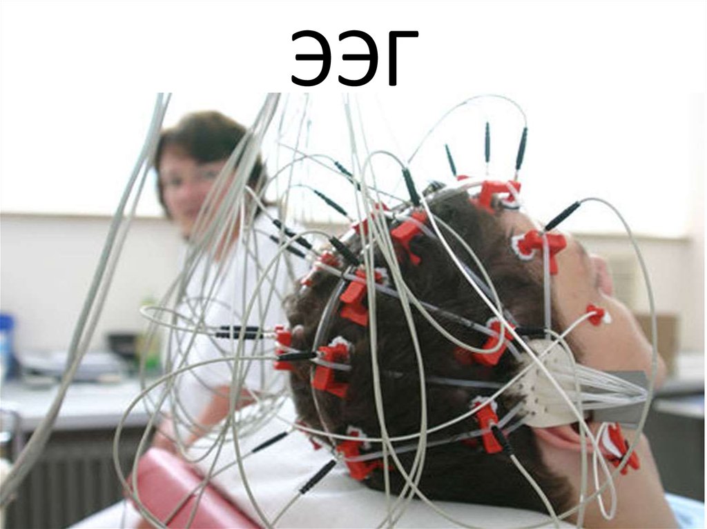Ээг невролог. РЭГ И ЭЭГ. ЭЭГ (электроэнцефалограмма) головного мозга. Электроэнцефалография, реоэнцефалография. Реоэнцефалография (РЭГ).