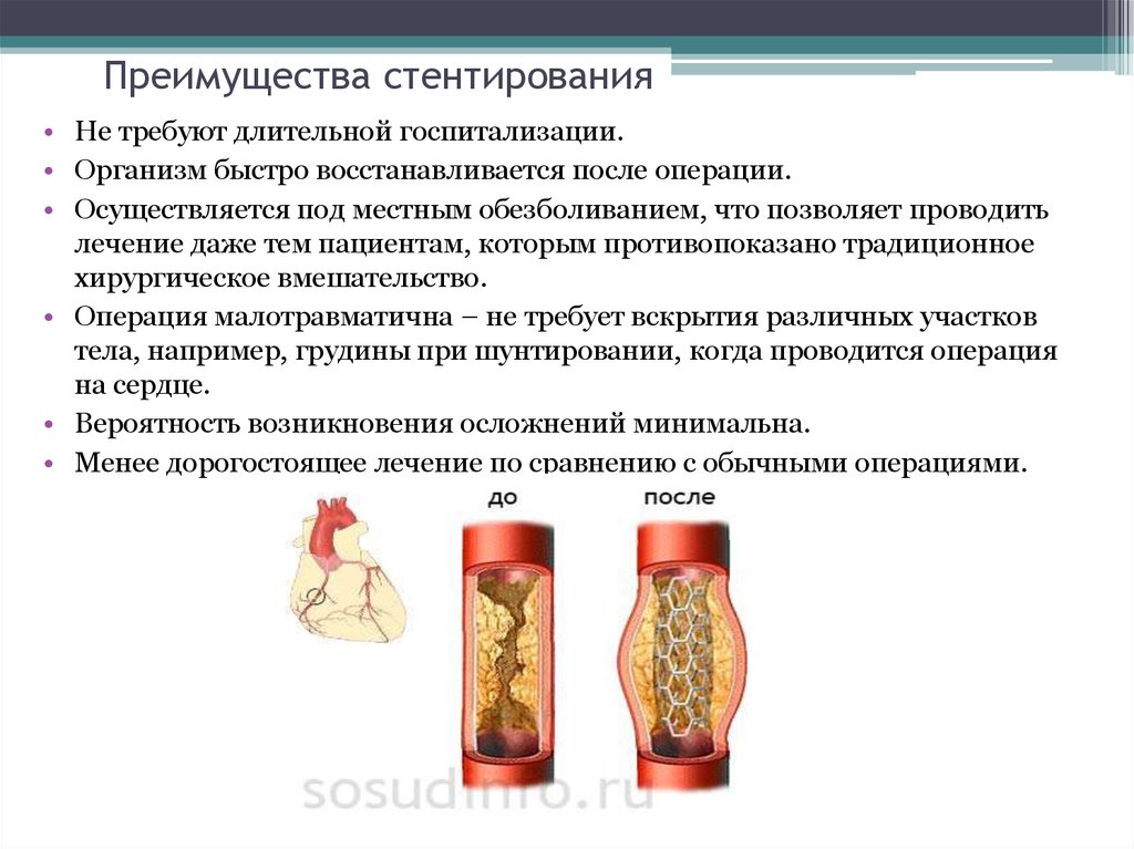 После стентирования. Лекарства после стентирования сосудов. Препараты после стентирования коронарных артерий. Препараты после стентирования коронарных сосудов. Противопоказания к стентированию коронарных сосудов.