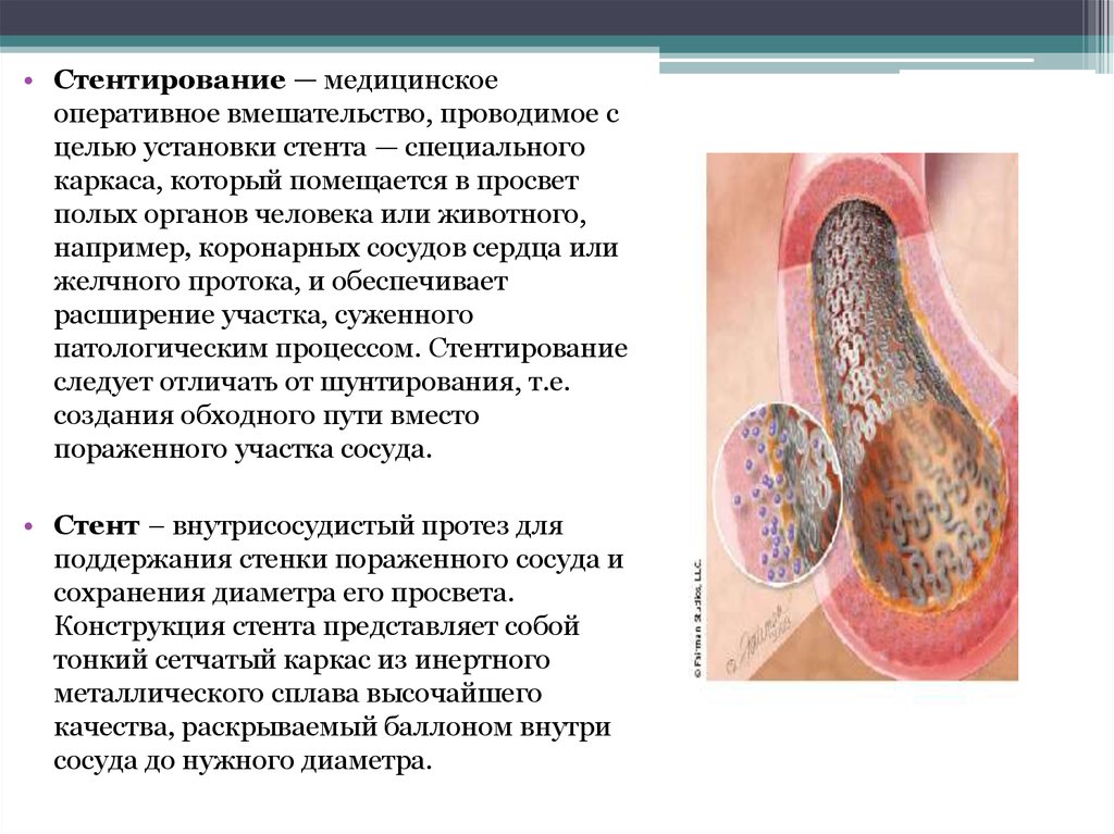 Методы обследования в кардиологии презентация