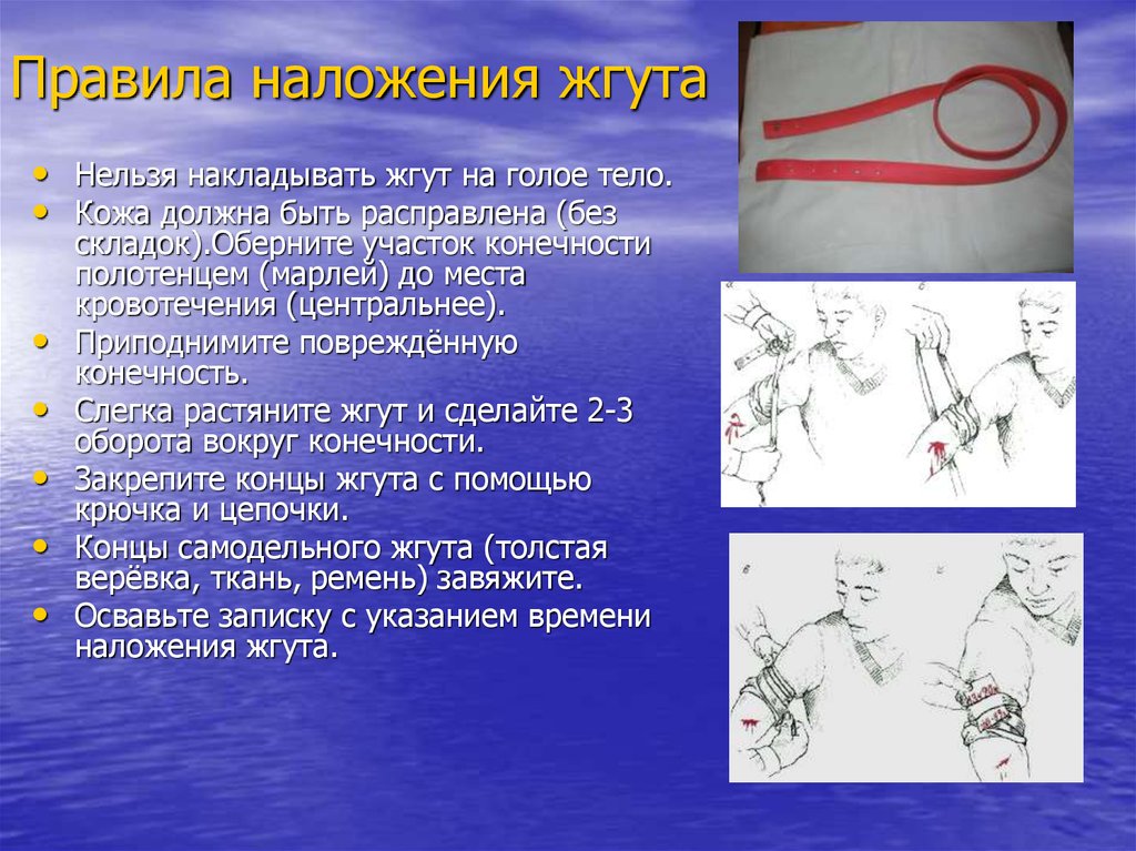 Жгут тело. Наложение жгута при внутривенной инъекции. Наложение жгута при взятии крови. Наложение жгута при заборе крови. Наложение жгута при введении внутривенной инъекции.