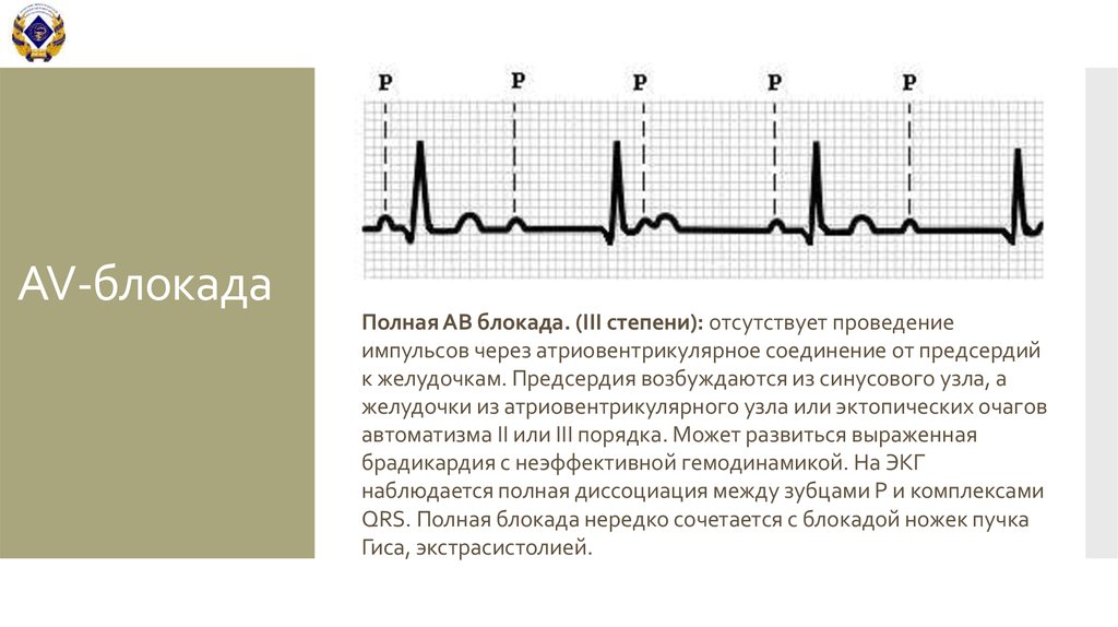 Ав блокада карта вызова